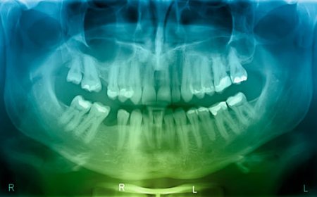 Modernieji odontologiniai tyrimai: ką pacientui svarbu žinoti prieš vizitą